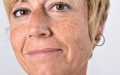 Clear Up Your Skin: How to Get Rid of Age Spots ASAP