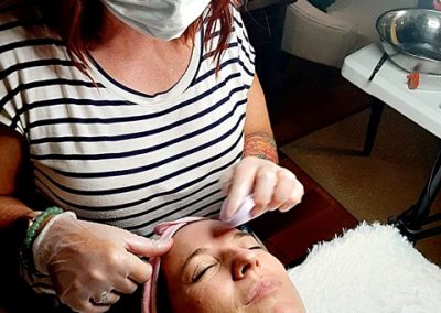 preparing for a biorevitalization peel