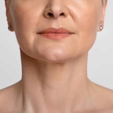 fibroblast skin tightening smooth skin